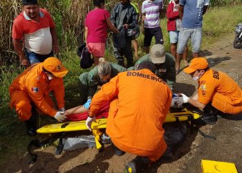 PORTO CALVO- Queda de moto deixa vítima bastante ferida na AL 105.