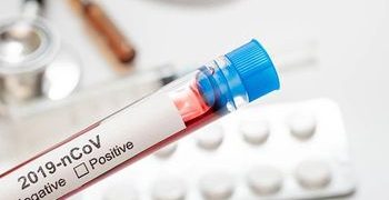 Passa de mil o número de pessoas com Covid-19 em Alagoas; número de óbitos subiu para 47