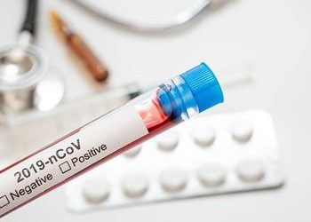 Passa de mil o número de pessoas com Covid-19 em Alagoas; número de óbitos subiu para 47