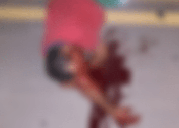 Acidente em Japaratinga